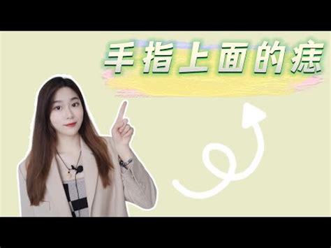 左手 痣|左手痣位置大不同,命運各異